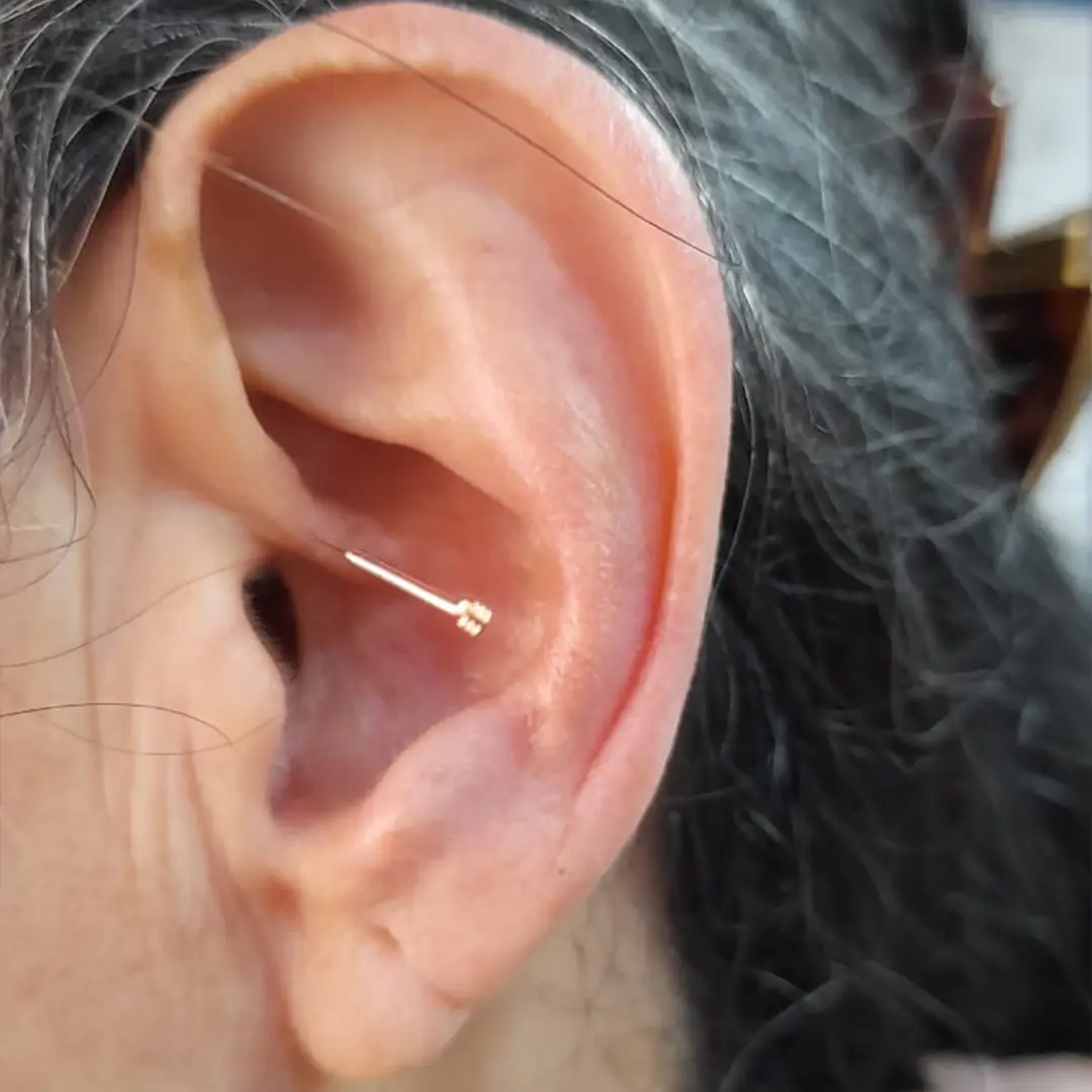 Grupo — Curso Auriculoterapia