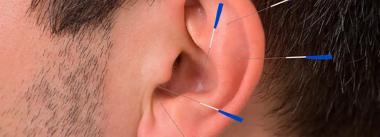 Imagen top Auriculo 2