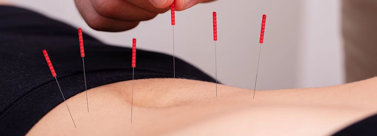 Imagen top del curso Acupuntura para Lifting Facial